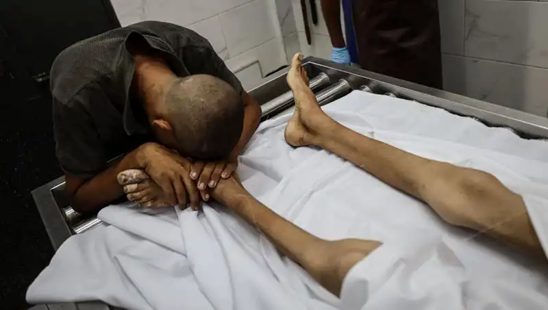 Gazze'de Açlık İle Savaşan Çocukların Dramı: Bir Can Daha Kaybedildi