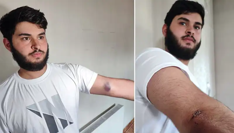 Mahallede Bahçeye Kaçan Top, Conoları Kamyonetle Getirdi!